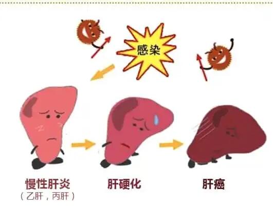 宅男视频APP网站廠家提醒肝髒疾病治不好？要了解是否含鐵食物攝入多